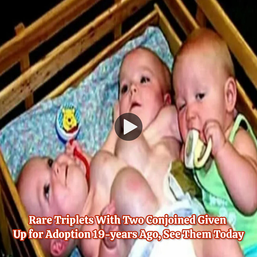 Rare Triplets With Two Conjoined Given Up for Adoption 19-years Ago, See Them Today